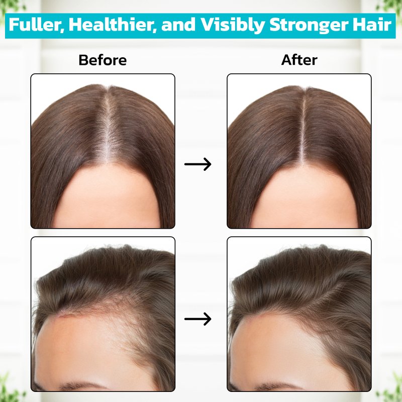 Minoxidil 2% (60ml)